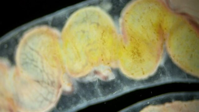 Worm from family Naididae under a microscope, possibly Tubifex. Found in silt of a hydrogen sulfide lake. Work of internal organs is visible