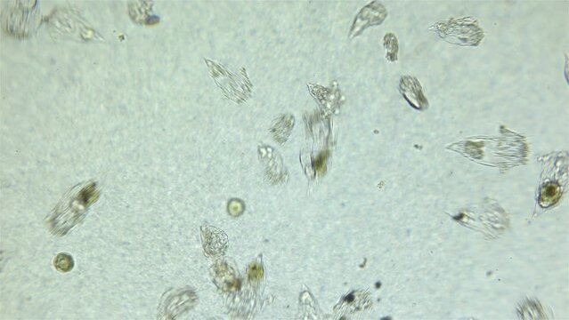 Colony rotifera Synchaeta sp. under a microscope, class Monogonta, family Synchaetidae. Freshwater plankton: ciliates and different types of rotifers. Specimens found in a freshwater pond.