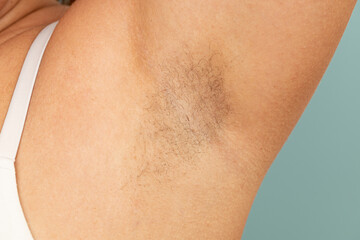 Woman touch hairy underarms with hand closeup, free copy space, yellow background. Raised arm with armpit hair. Female beauty trend, freedom, feminism, body positive, naturalness. Hygiene concept. - obrazy, fototapety, plakaty