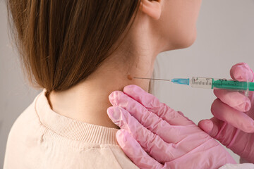 Dermatologist taking puncture from young woman's mole on grey background, closeup