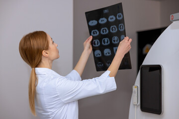 Young adult blonde female doctor checking mri picture in clinic.