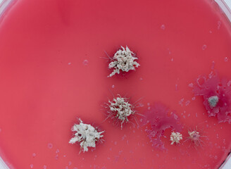 colonies of microorganisms