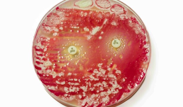 testing microorganisms for antibiotic resistance