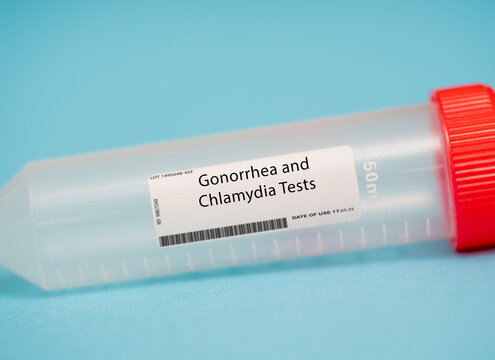 Gonorrhea and Chlamydia Tests