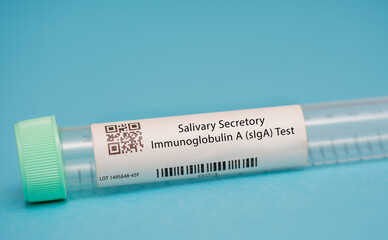 Salivary Secretory Immunoglobulin A (sIgA) Test