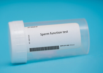 Fototapeta na wymiar Sperm function test