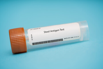 Stool Antigen Test