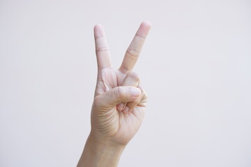 Woman holding up two fingers to symbolize fighting