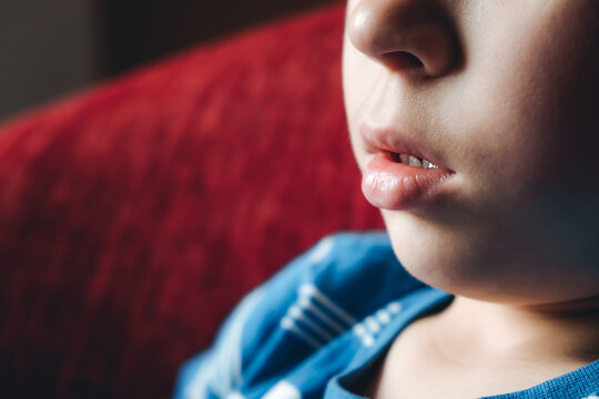 Closeup face profile. Lips of child. 6 year boy with open mouth close-up. Weak facial muscles. Copy space. Mouth breathing. The concentrating kid. Nasal congestion. Dry air. Runny nose. White skin.