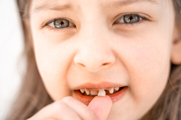 Charming smiling little girl kid with opened mouth shows staggering loose falling out first baby milk front tooth. Preschooler teeth changing. Healthy dental hygiene. Lost tooth. Dentist treatment