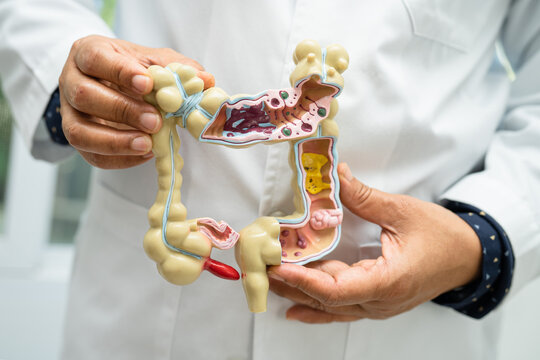 Intestine, appendix and digestive system, doctor holding anatomy model for study diagnosis and treatment in hospital.