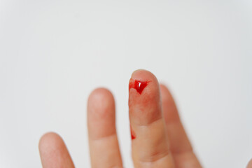 cut on the pad of the finger. blood from a wound on arm on a white background.