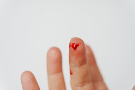 cut on the pad of the finger. blood from a wound on arm on a white background.