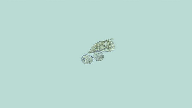 Rotifera Keratella sp. under a microscope, family Brachionidae. It has cosmopolitan distribution. Sample found in freshwater pond. Famale with eggs