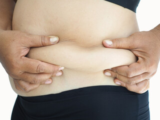 Woman pulls the hand skin showing fat in the side abdomen. the deposition of subcutaneous fat tissue. closeup photo, blurred.