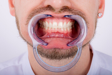 Man patient with retractor standing with open mouth in dental clinic