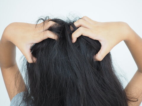Little girl is scratching her head on white background. Closeup photo, blurred.