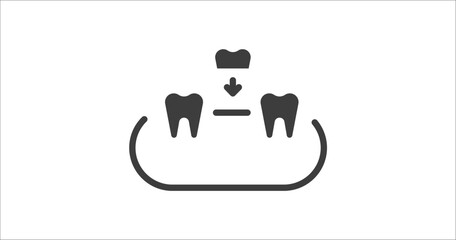 overdenture icon. Filled overdenture icon from dental health collection. Glyph vector. Editable overdenture symbol can be used web and mobile