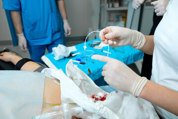Epidural catheter in the hands of an anesthesiologist. Selective focus. Preparing the patient for surgery. spinal anesthesia.