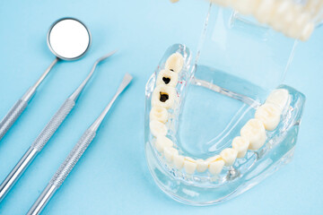 The Healthy and decayed teeth model and mouth mirror, Dental concepts.