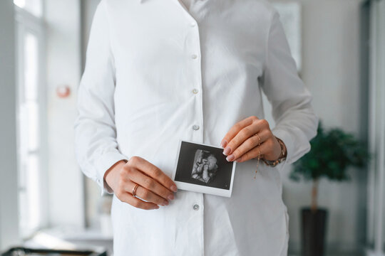 Woman in white coat is holding ultrasound picture of baby photo