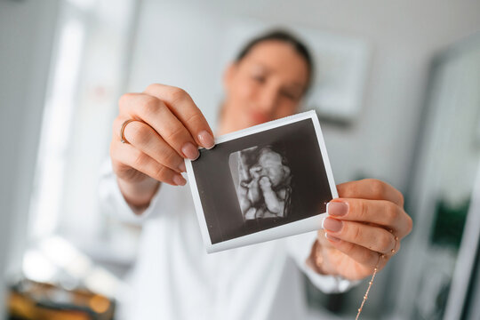 Standing and smiling. Woman in white coat is holding ultrasound picture of baby photo