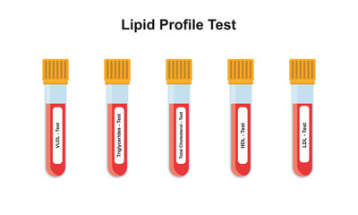 Lipid Profile Test Concept Design. Vector Illustration.