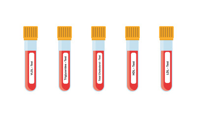 Lipid Profile Test Concept Design. Vector Illustration.	
