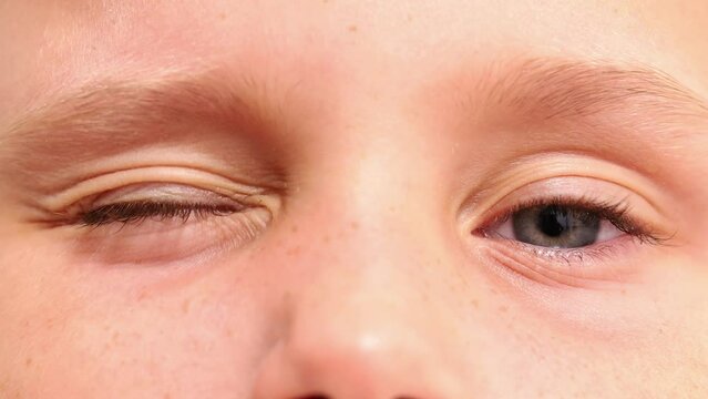 Cropped playful, merry, cheerful, adorable and kind girl blue eyes winking at camera. Everything good, alright, done. Human children eyes, pupils and eye iris. Vision, sight correction treatment