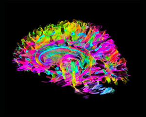 Colorful brain