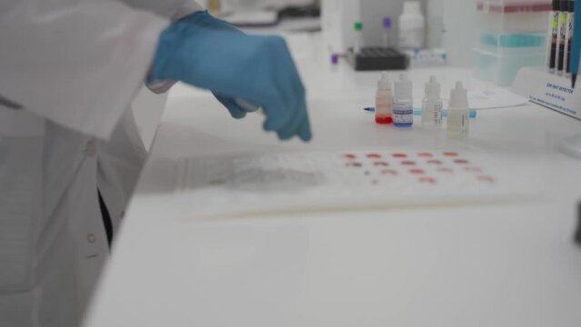 Laboratory determination of blood type. Blood test. Female laboratory assistant makes blood test, blood samples placed in cells on chart to determine the group and Rh factor. Recipient and donor. 