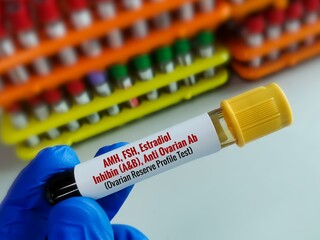 Doctor Holding a blood sample for Ovarian Reserve Test, ORT is a test combination of FSH, Estradiol, AMH (Anti-mullerian hormone), Inhibin (A,B)and Anti ovarian antibody.