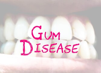 Gum disease medical term with blur infected teeth background . Medical concept.
