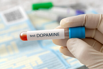 Blood sample for Dopamine test on blue laboratory background.
