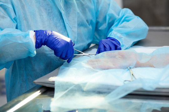 Close-up image of doctor's hands in protective gloves, surgeon leading operation on human hands, holding instruments. Plastic surgery. Concept of medicine, hospital, healthcare, treatment, profession
