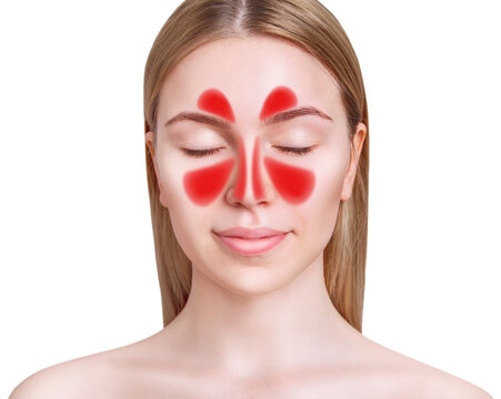 Face with inflammation of mucous membrane of paranasal sinuses.
