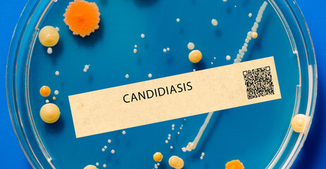 Candidiasis - Fungal infection that can affect the skin, mouth, and genitals.