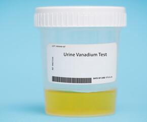Urine vanadium test