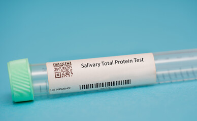 Salivary Total Protein Test