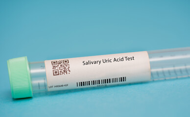Salivary Uric Acid Test