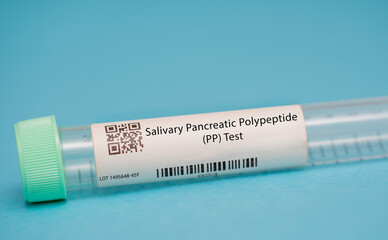 Salivary Pancreatic Polypeptide (PP) Test