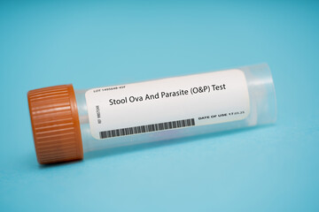 Stool Ova And Parasite (O&P) Test