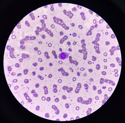 Atypical lympho cyte in red blood cell background.
