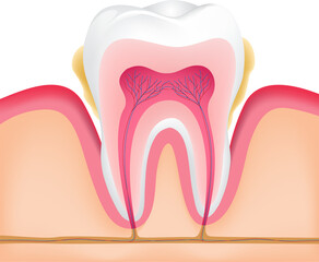 Tooth ploblem with gum disease. Dental care concept, illustration.