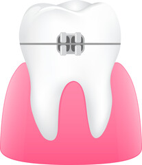 Tooth braces illustration. Dental care concept.