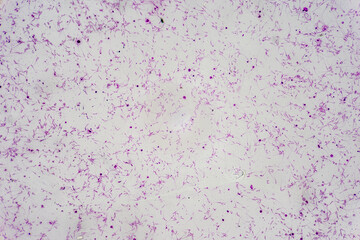 Histological Spermatic cord human, Seminal vesicle human, Prostate human and Human chromosomes under the microscope for education.