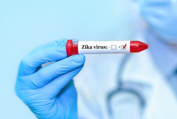 Fototapeta premium Doctor holding a test blood sample tube positive with Zika virus test