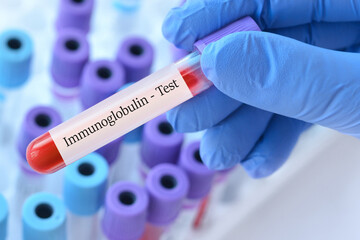 Fototapeta premium Doctor holding a test blood sample tube with Immunoglobulin test on the background of medical test tubes with analyzes.Banner
