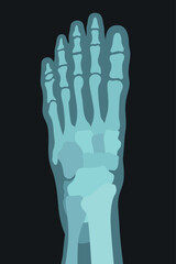 X ray image of human foot top view transparent silhouette bone anatomy vector flat illustration