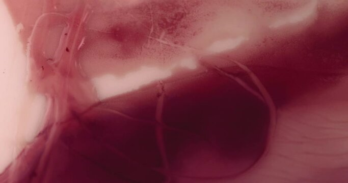 clinical depression inside view